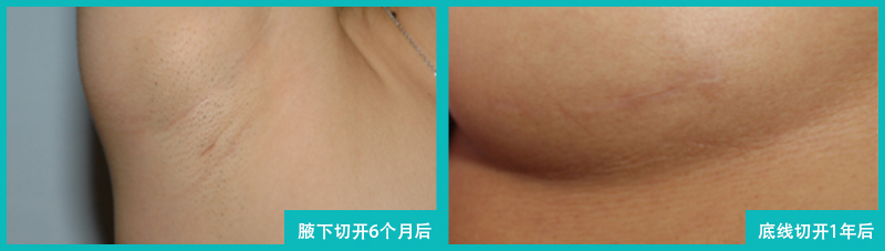 术后管理项目