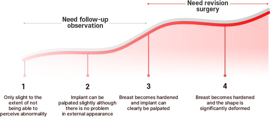 Breast Revision Surgery