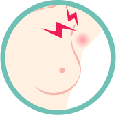 Breast Cancer