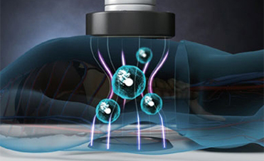 High-Frequency Thermal Cancer Treatment