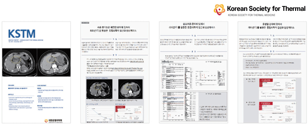 High-Frequency Thermal Cancer Treatment