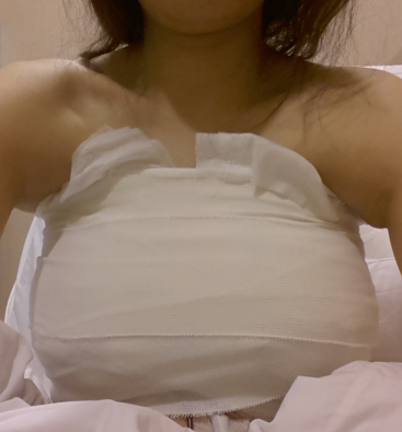 MD 수술후기
