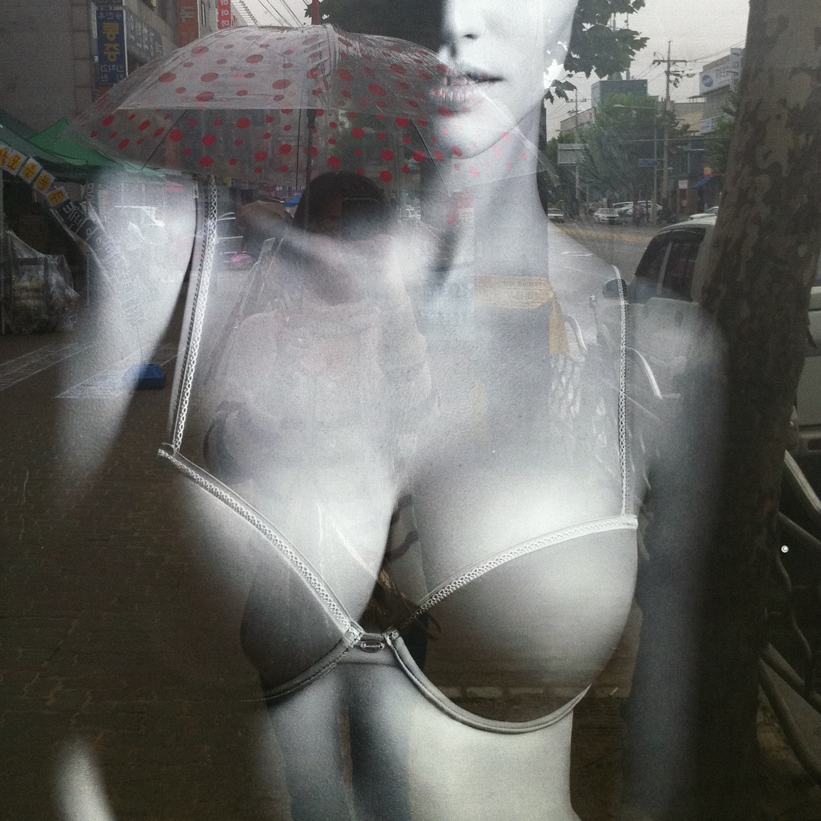 MD 수술후기