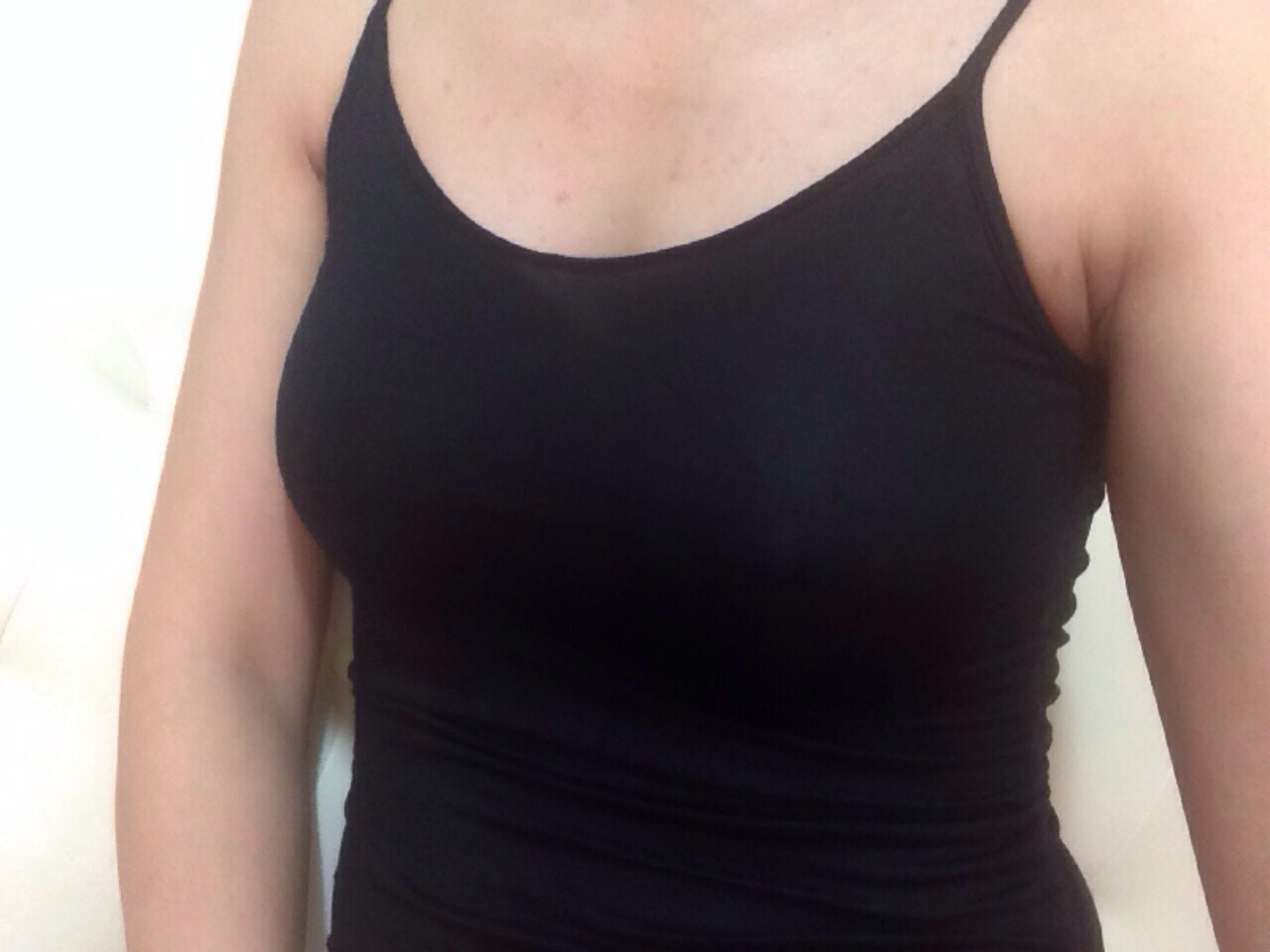 MD 수술후기