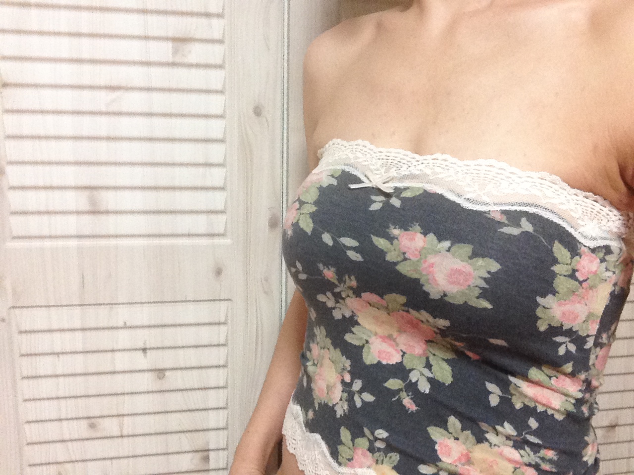 MD 수술후기