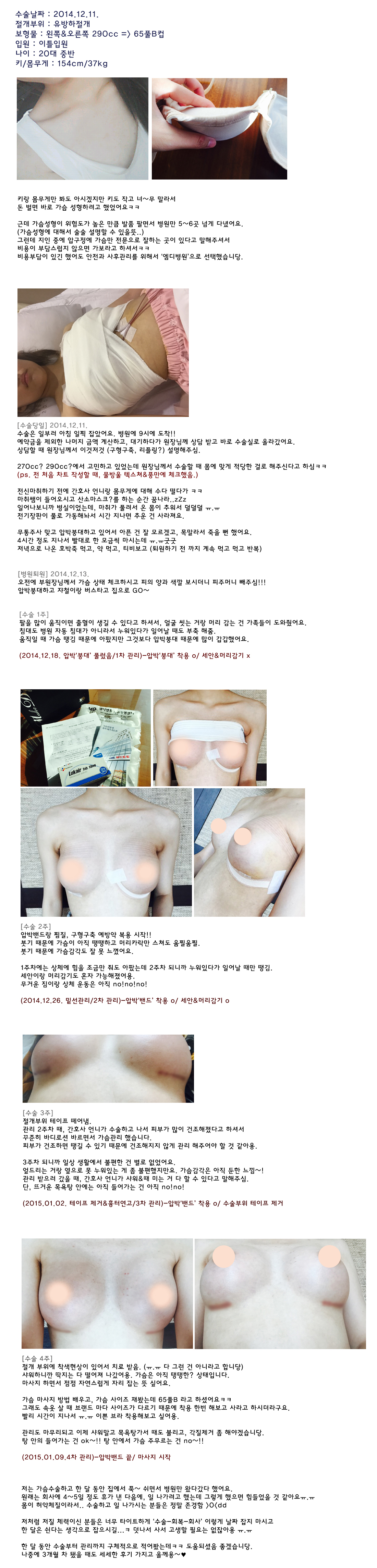 MD 수술후기