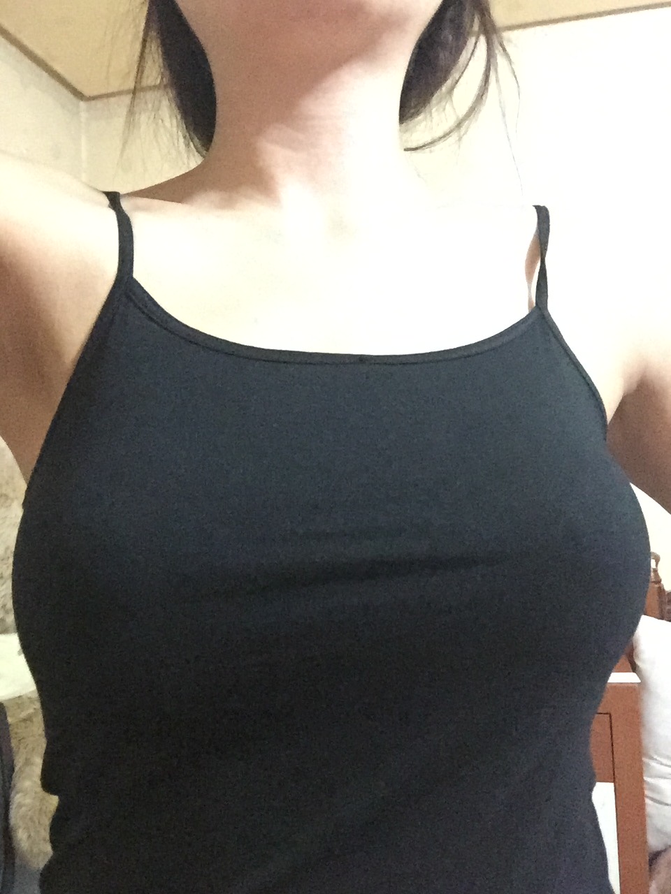 MD 수술후기