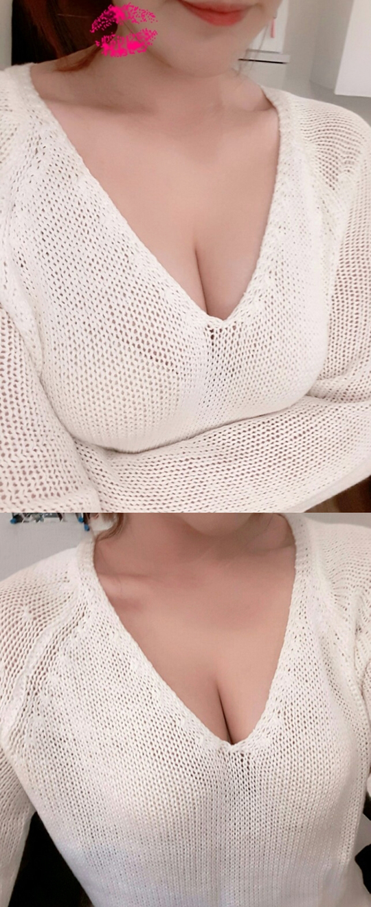 MD 수술후기
