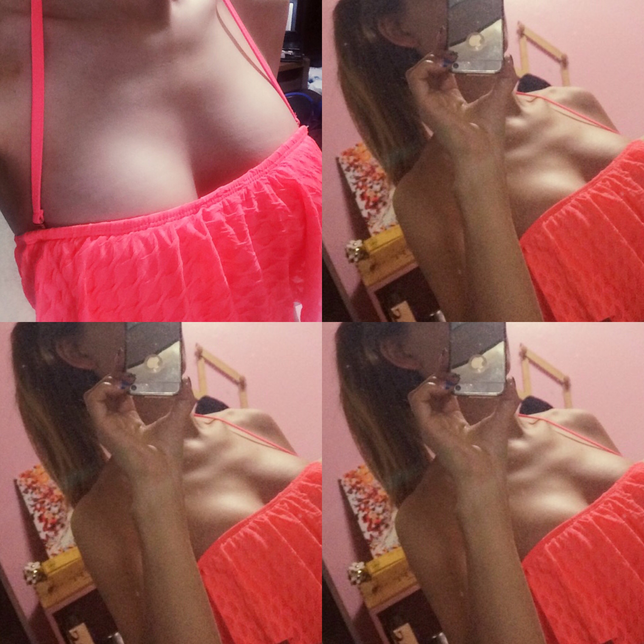 MD 수술후기