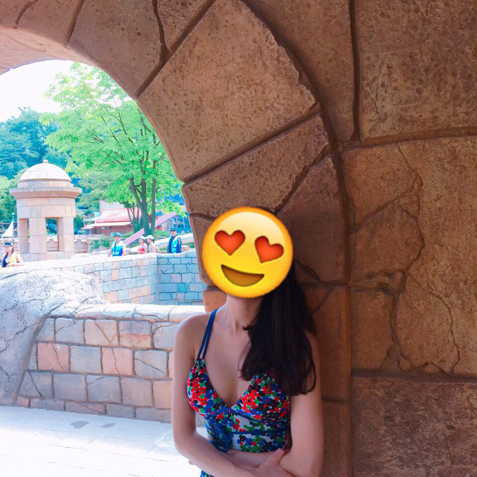 MD 수술후기