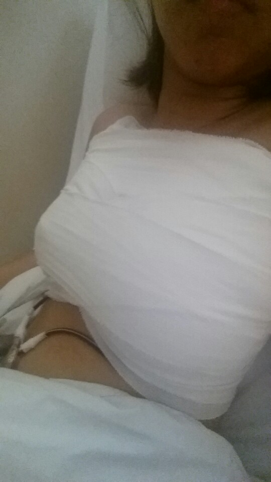 MD 수술후기