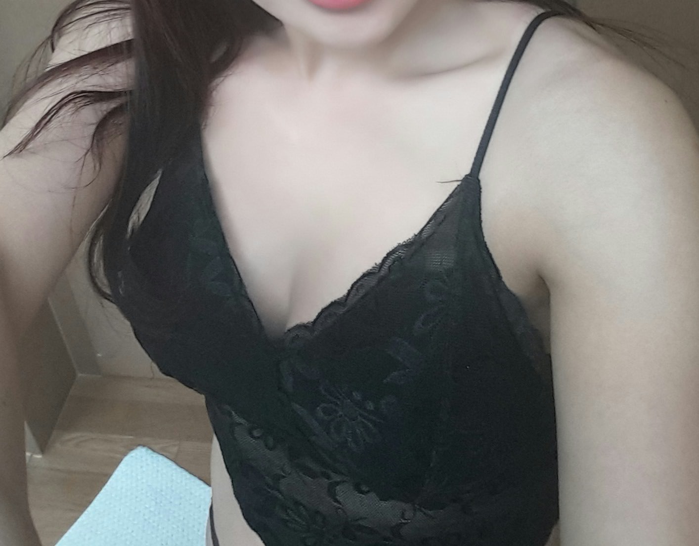 MD 수술후기