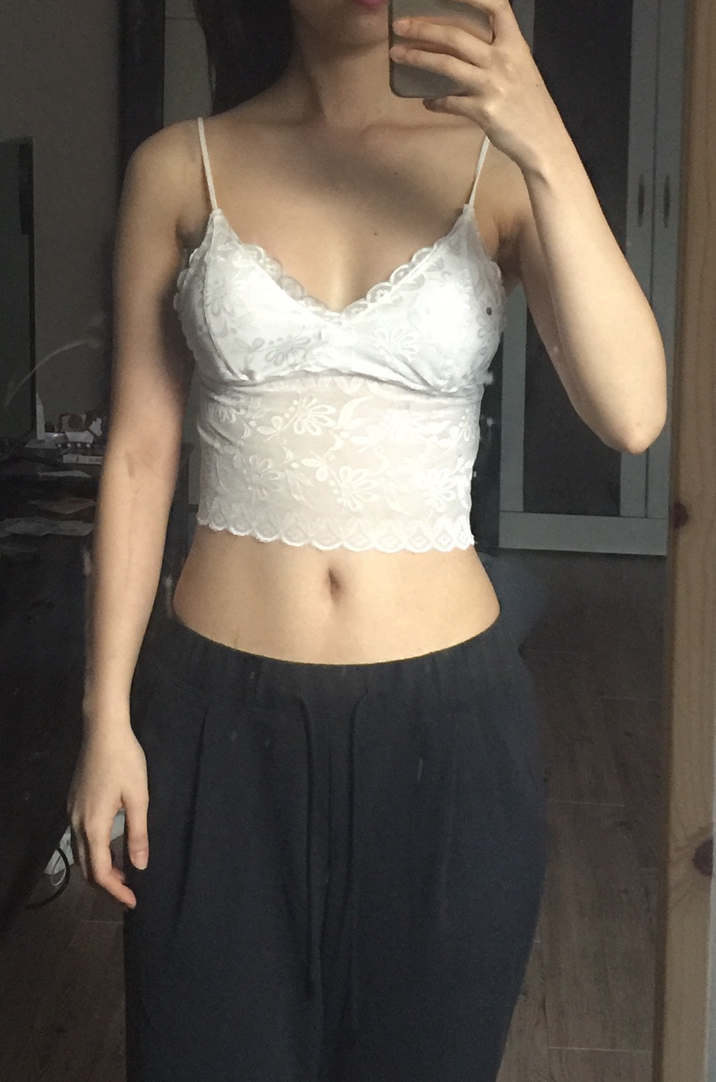 MD 수술후기