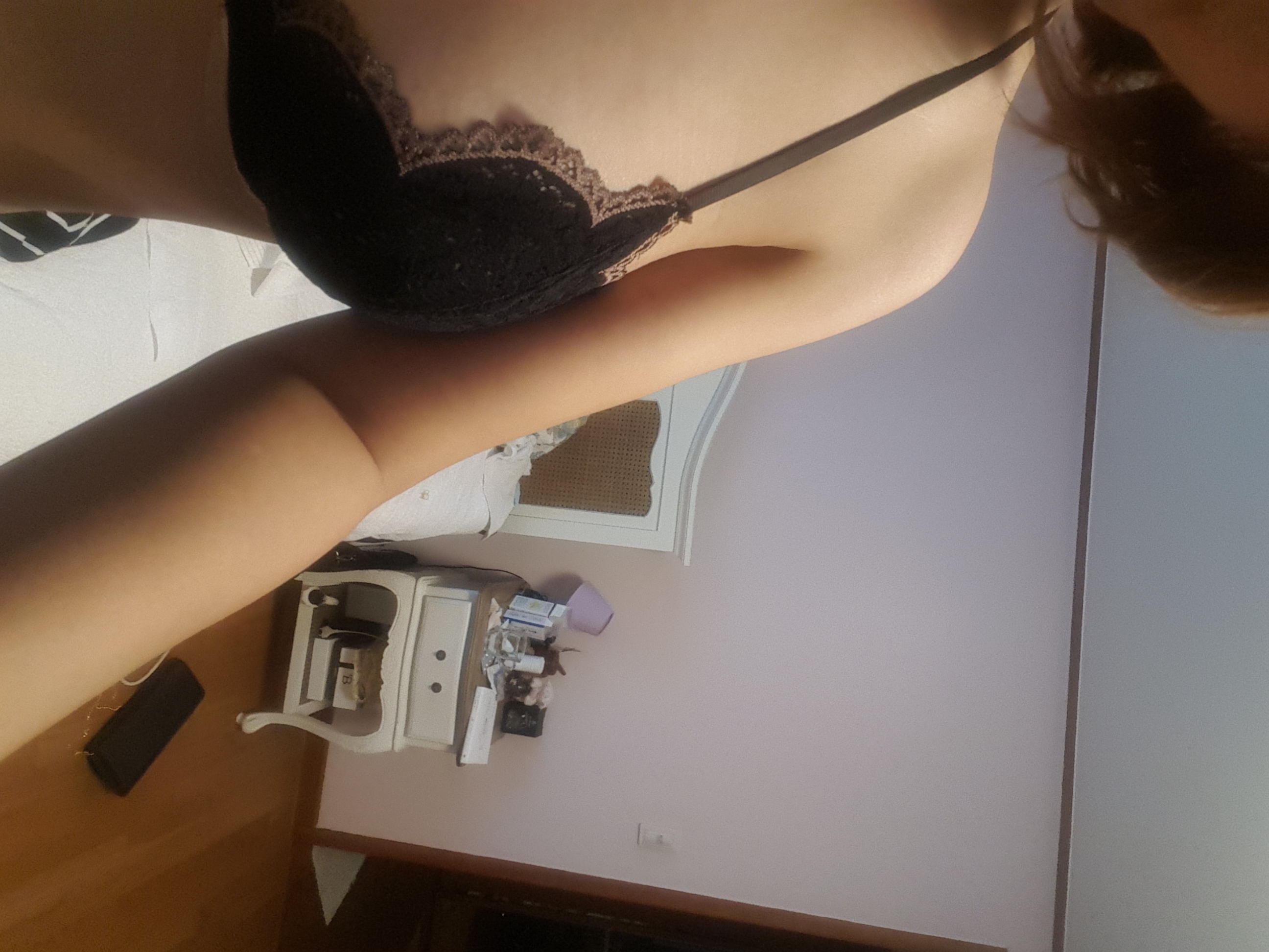 MD 수술후기