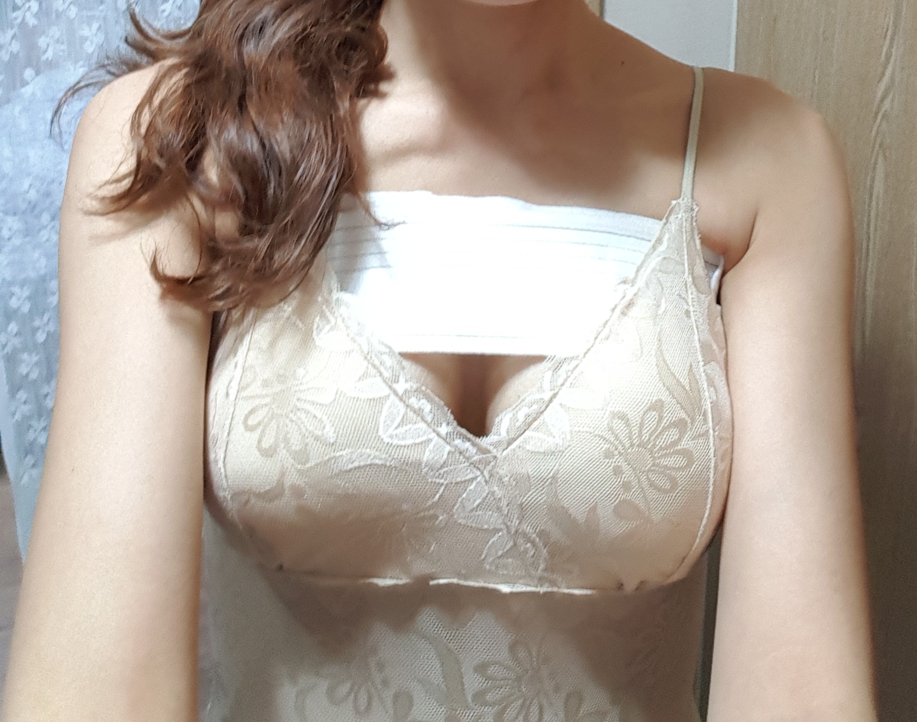 MD 수술후기