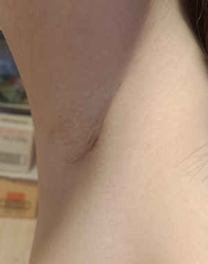After