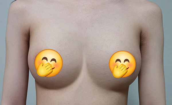 MD 수술후기